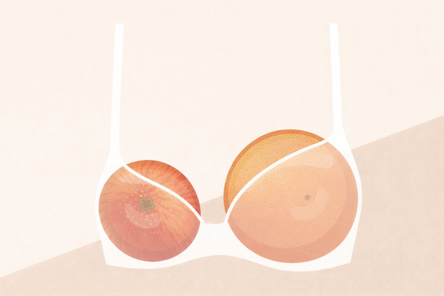 Hablemos de asimetría mamaria